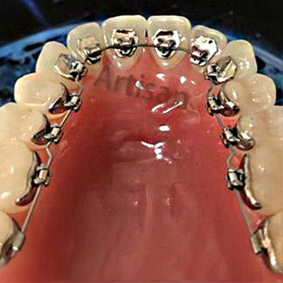 <strong>牙齒矯正精密零（líng）部件（jiàn）加工,,</strong>